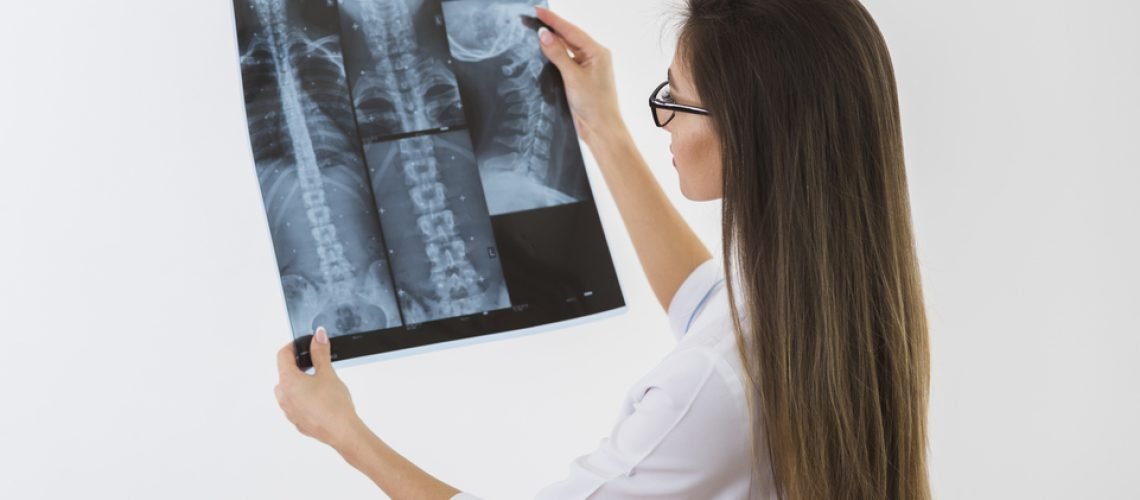 female-doctor-looking-radiography (1) (1)